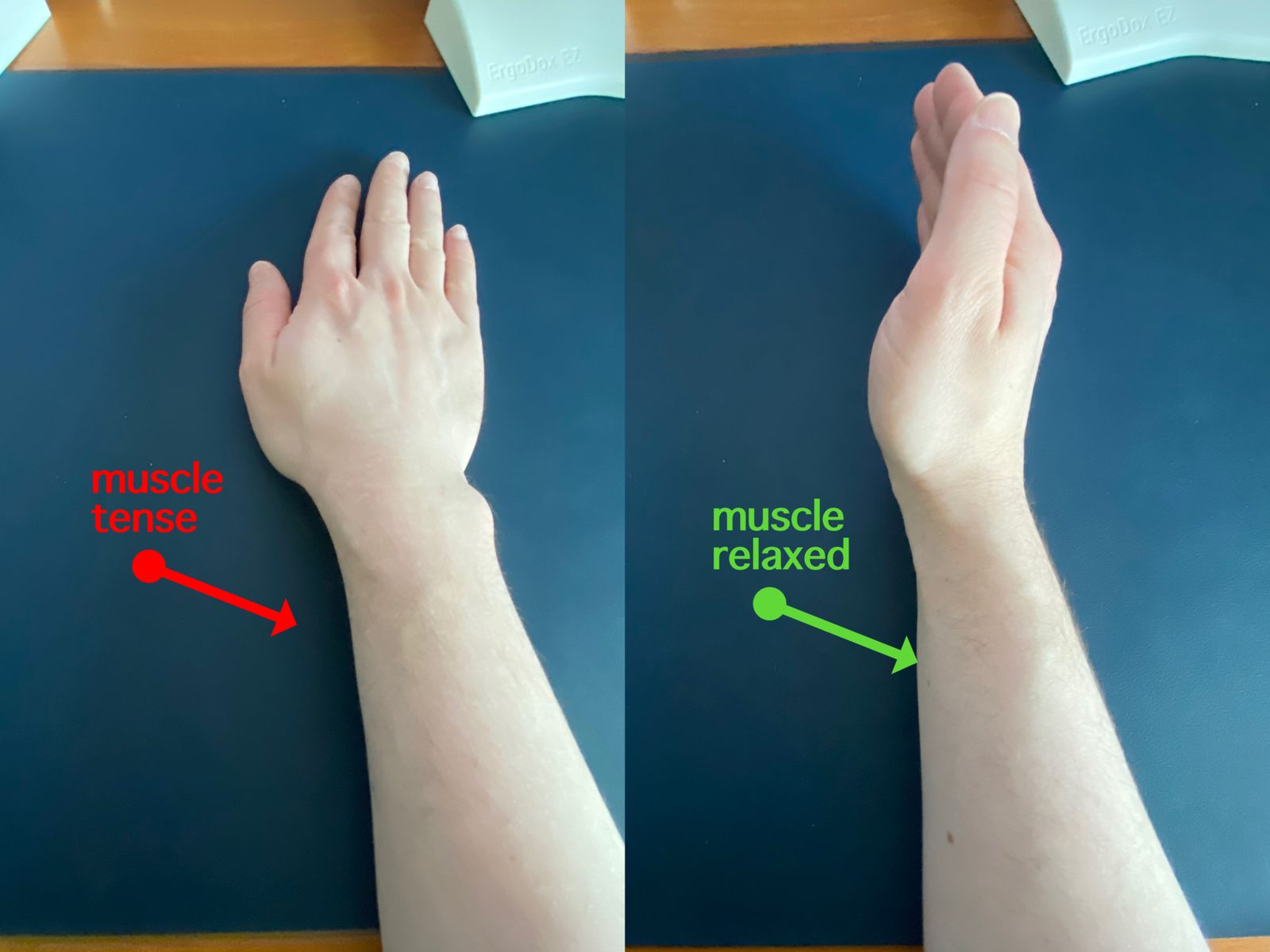 i-relearned-typing-to-save-my-wrists